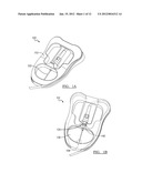 CATHETER STABILIZATION DEVICE diagram and image