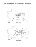 CATHETER STABILIZATION DEVICE diagram and image