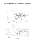 CATHETER STABILIZATION DEVICE diagram and image