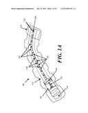 METHODS AND DEVICES FOR APPLYING CLOSED INCISION NEGATIVE PRESSURE WOUND     THERAPY diagram and image