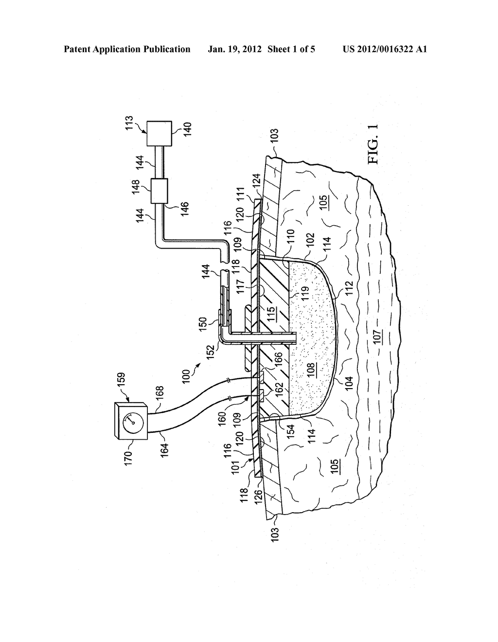 SYSTEMS AND METHODS FOR ELECTRICALLY DETECTING THE PRESENCE OF EXUDATE IN     DRESSINGS - diagram, schematic, and image 02