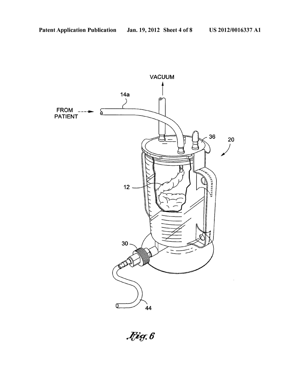 Collection canister apparatus for closed loop fat harvesting system and     method of use thereof - diagram, schematic, and image 05