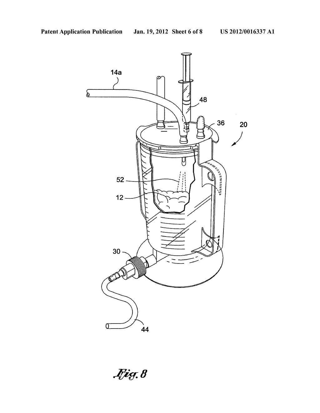 Collection canister apparatus for closed loop fat harvesting system and     method of use thereof - diagram, schematic, and image 07