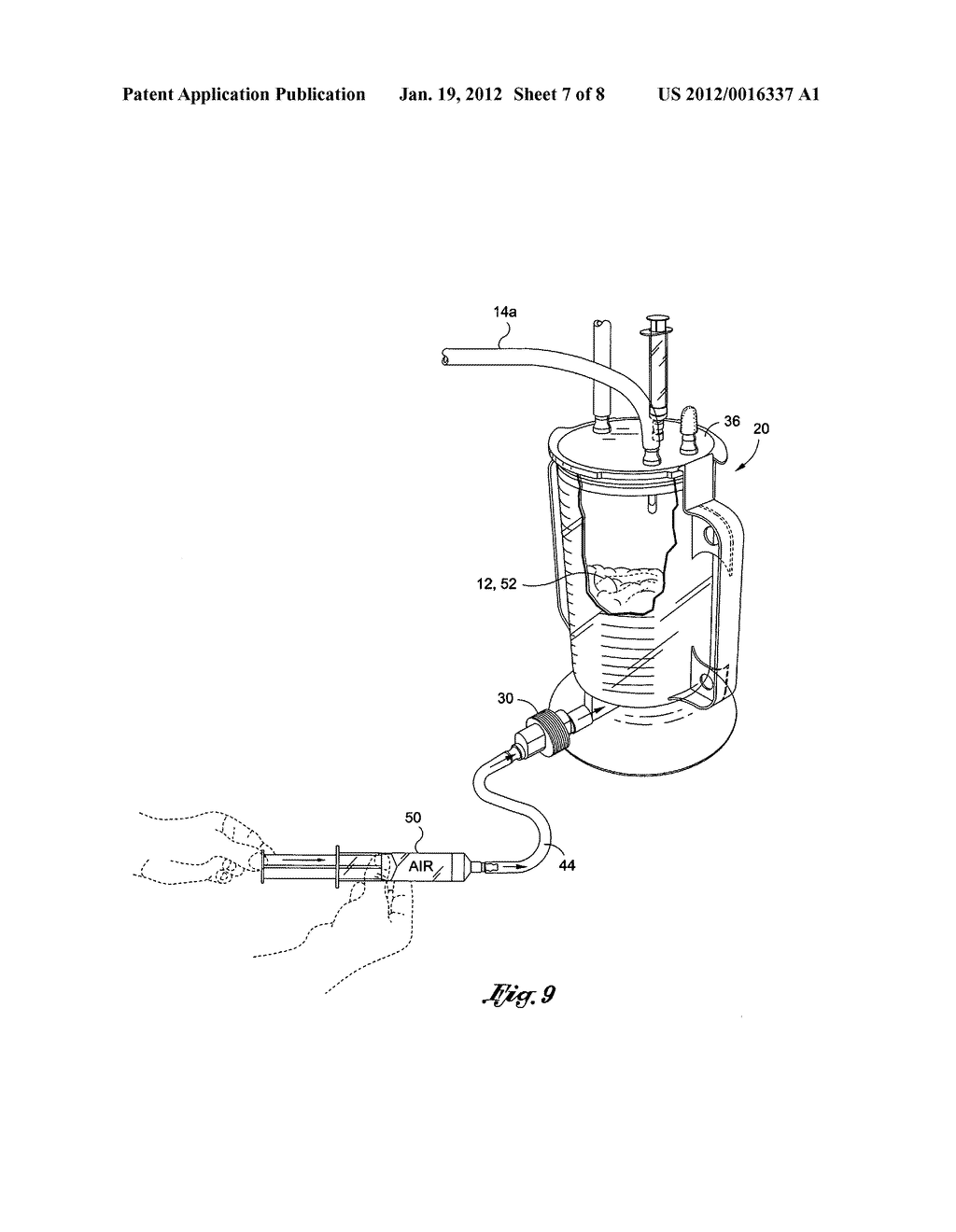 Collection canister apparatus for closed loop fat harvesting system and     method of use thereof - diagram, schematic, and image 08