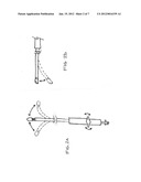 Method and Apparatus for Intraoperative Cardiac Tissue Injection diagram and image