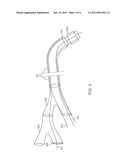 GUIDING CATHETER STABILIZATION SYSTEM diagram and image