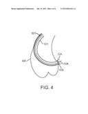 GUIDING CATHETER STABILIZATION SYSTEM diagram and image