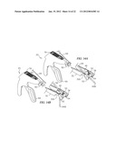 METHOD AND APPARATUS FOR CLOSING AN OPENING IN THICK, MOVING TISSUE diagram and image