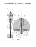 METHOD FOR SUTURING diagram and image