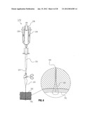 METHOD FOR SUTURING diagram and image