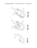 METHOD FOR SUTURING diagram and image