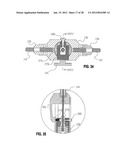 METHOD FOR SUTURING diagram and image