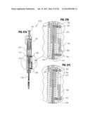 METHOD FOR SUTURING diagram and image