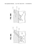METHOD FOR SUTURING diagram and image