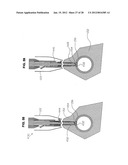 METHOD FOR SUTURING diagram and image