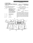 SPINAL STABILIZATION SYSTEM WITH RIGID AND FLEXIBLE ELEMENTS diagram and image