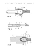 SPINAL STABILIZATION SYSTEM WITH RIGID AND FLEXIBLE ELEMENTS diagram and image