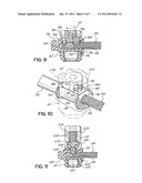 SPINAL STABILIZATION SYSTEM WITH RIGID AND FLEXIBLE ELEMENTS diagram and image