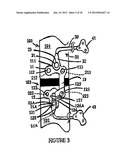 OSTEOSYNTHESIS DEVICE diagram and image