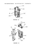 OSTEOSYNTHESIS DEVICE diagram and image