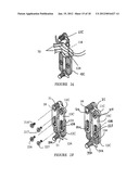 OSTEOSYNTHESIS DEVICE diagram and image