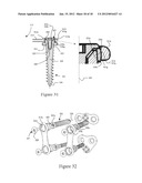 OSTEOSYNTHESIS DEVICE diagram and image