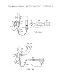 Stent Graft Delivery System diagram and image