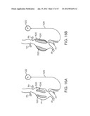 Stent Graft Delivery System diagram and image