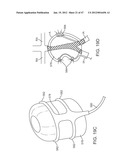 Stent Graft Delivery System diagram and image