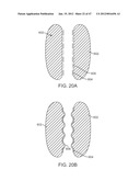 Stent Graft Delivery System diagram and image