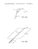 Stent Graft Delivery System diagram and image