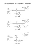 Stent Graft Delivery System diagram and image