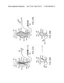 Stent Graft Delivery System diagram and image