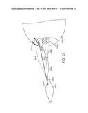 Stent Graft Delivery System diagram and image