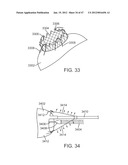 Stent Graft Delivery System diagram and image