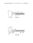 Stent Graft Delivery System diagram and image