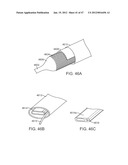 Stent Graft Delivery System diagram and image