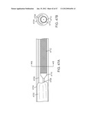 Stent Graft Delivery System diagram and image