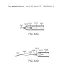 Stent Graft Delivery System diagram and image