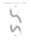  MEDICAL DEVICE SUITABLE FOR LOCATION IN A BODY LUMEN diagram and image