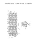 Stent diagram and image