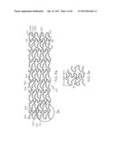 Stent diagram and image