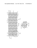 Stent diagram and image