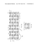 Stent diagram and image