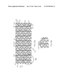 Stent diagram and image