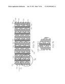 Stent diagram and image