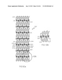 Stent diagram and image