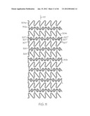 Stent diagram and image