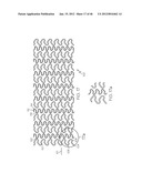 Stent diagram and image