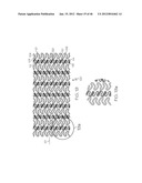 Stent diagram and image